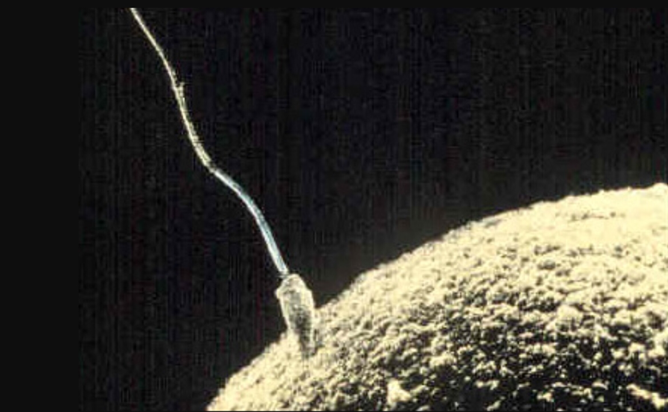 espermatozoide_ovulo_fecundacion_celula_reproduccion_concepcion_anticonceptivos_