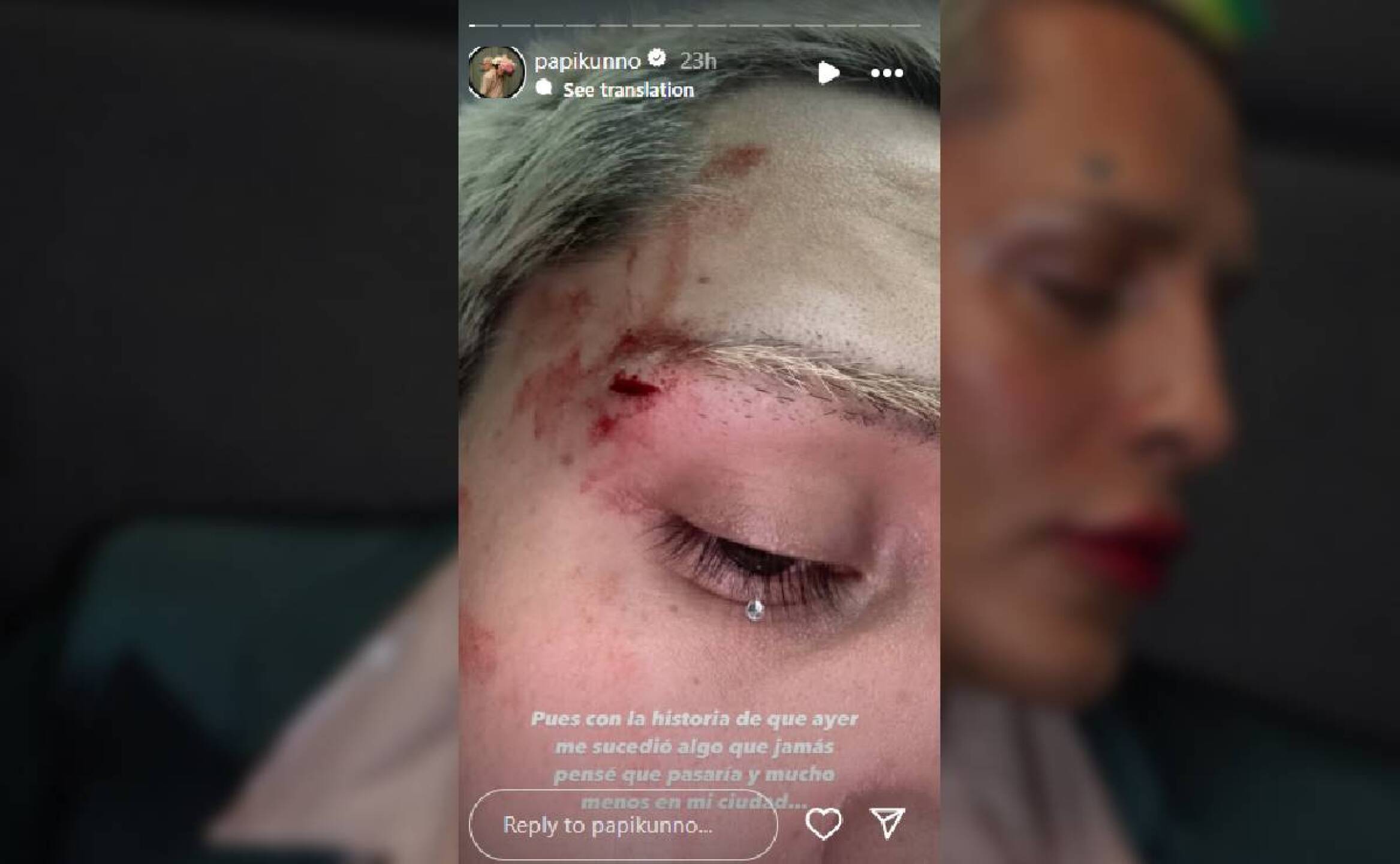 kunno-agresiones (1).jpg