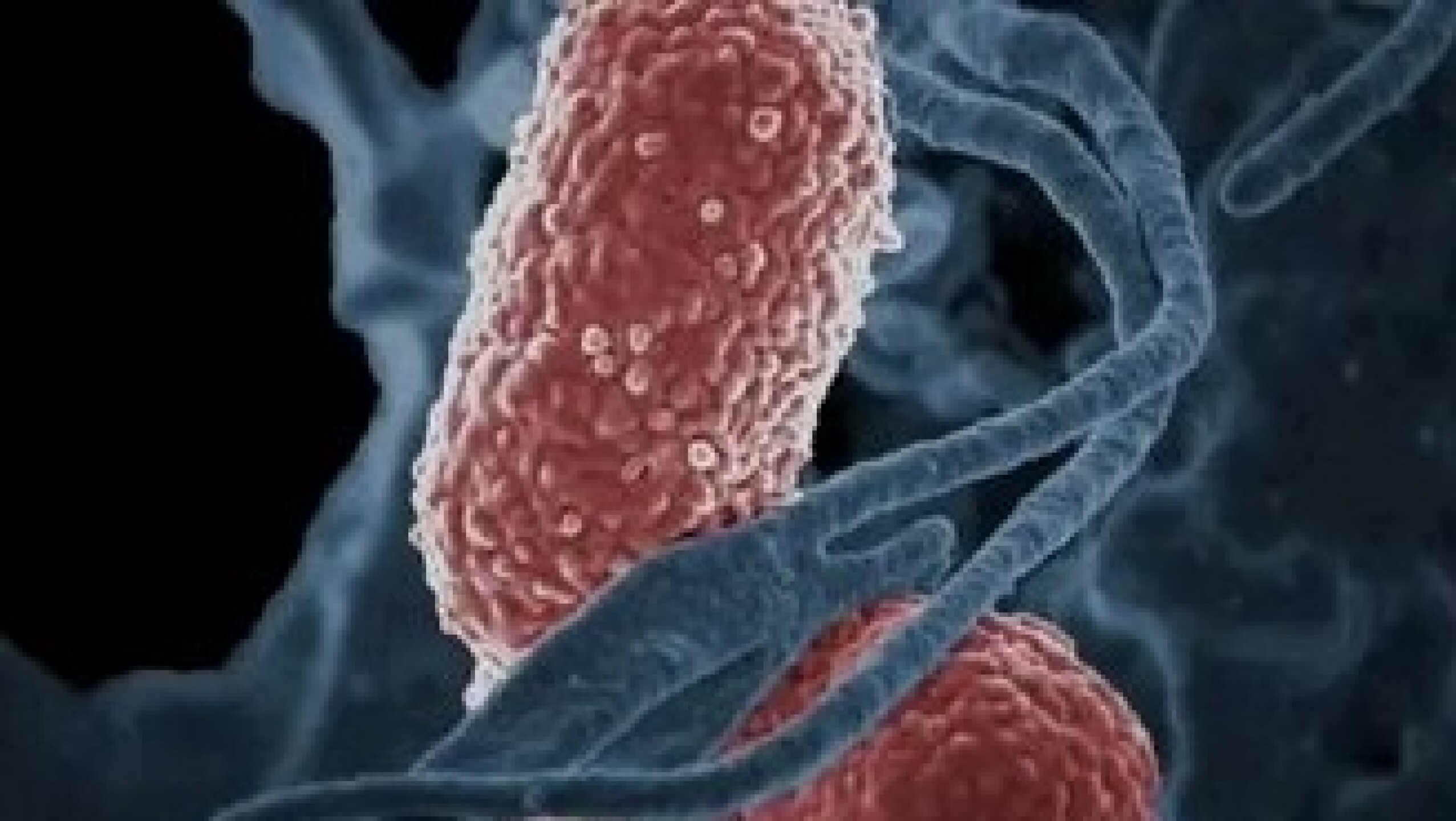 Klebsiella oxytoca