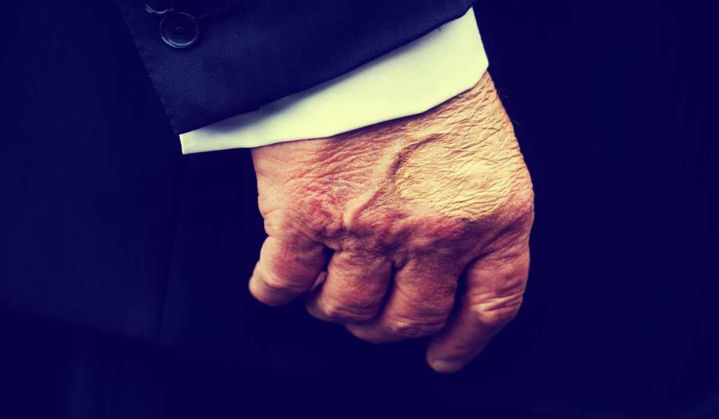 donald-trump-moretones-mano.jpg