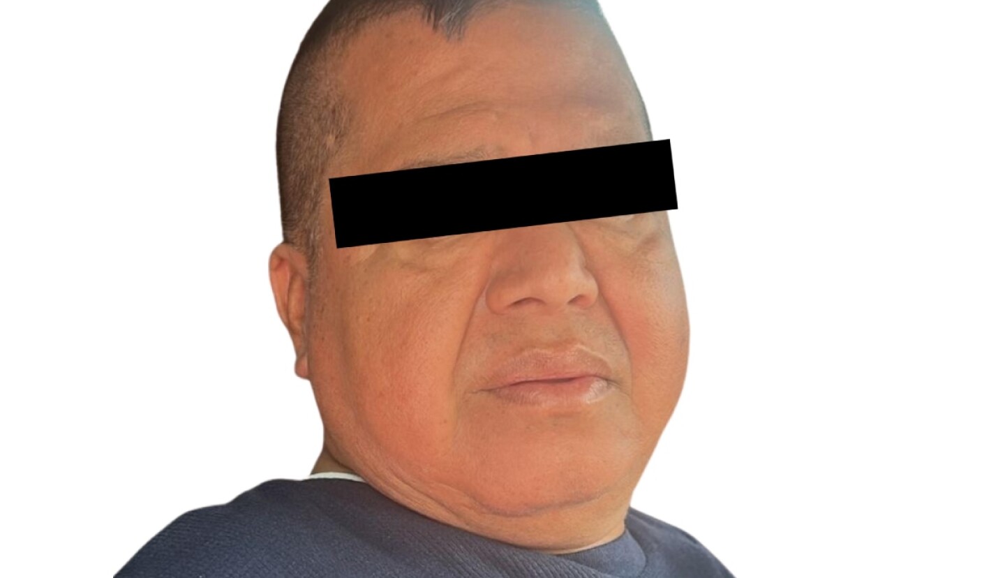 el mimoso.jpg