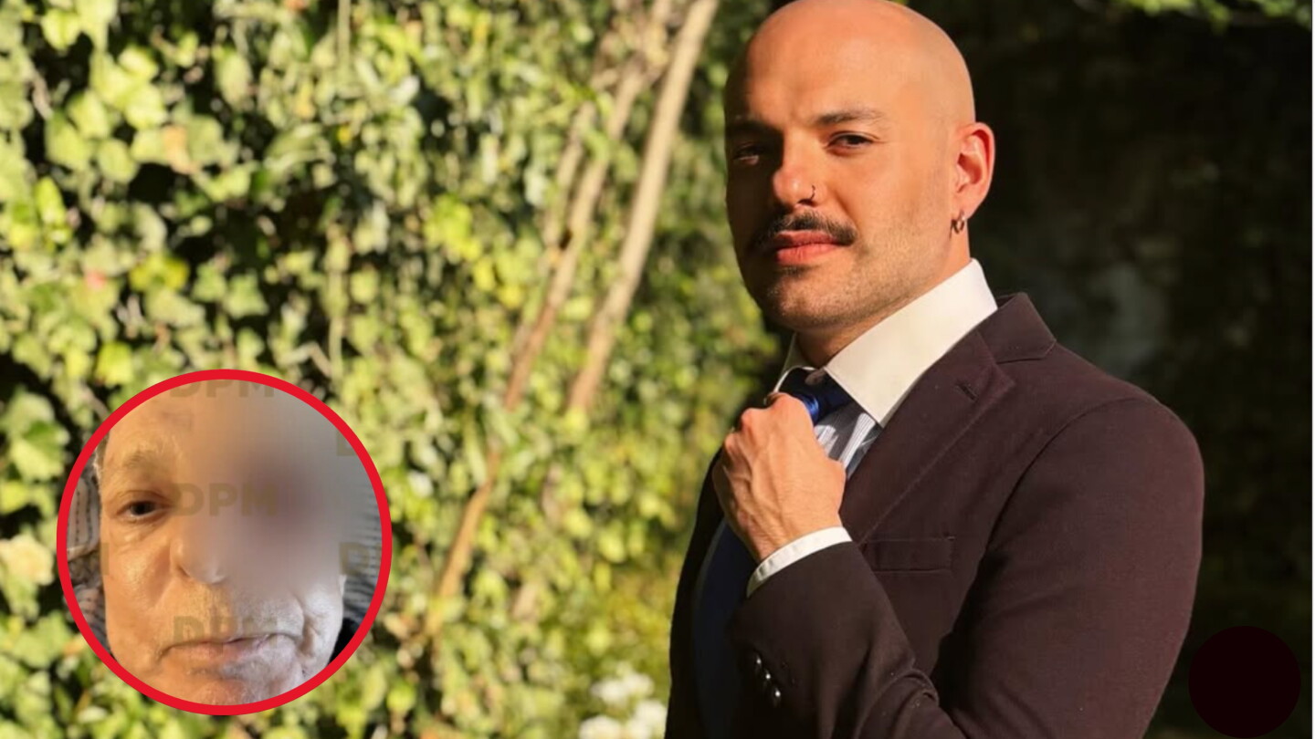 Falso que César Bono perdió el ojo izquierdo? Esto dijo el hijo del actor sobre la salud de su padre