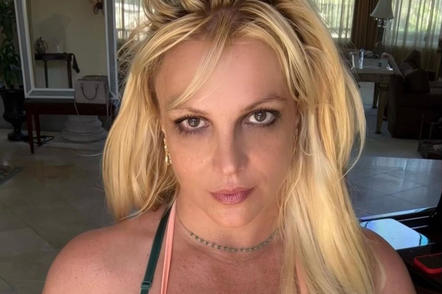 britney-spears-botox