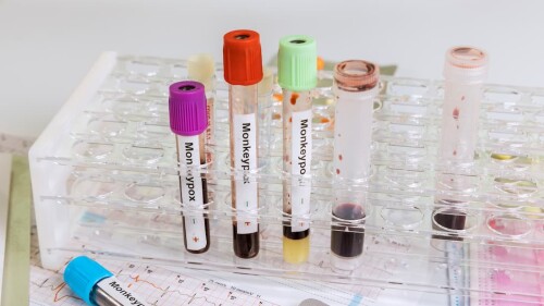 mpox virus tubos 8