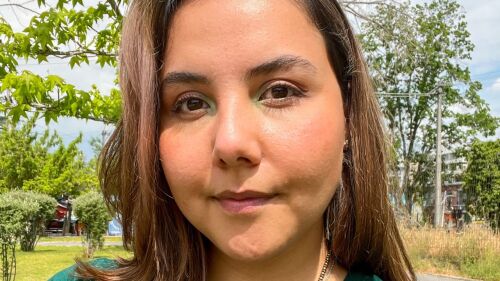 La Tiktoker chilena que muestra su vida con lipedema