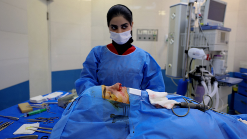 cirugias-esteticas-en-mujeres-iranies-en-aumento.png