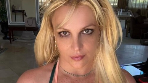 britney-spears-botox