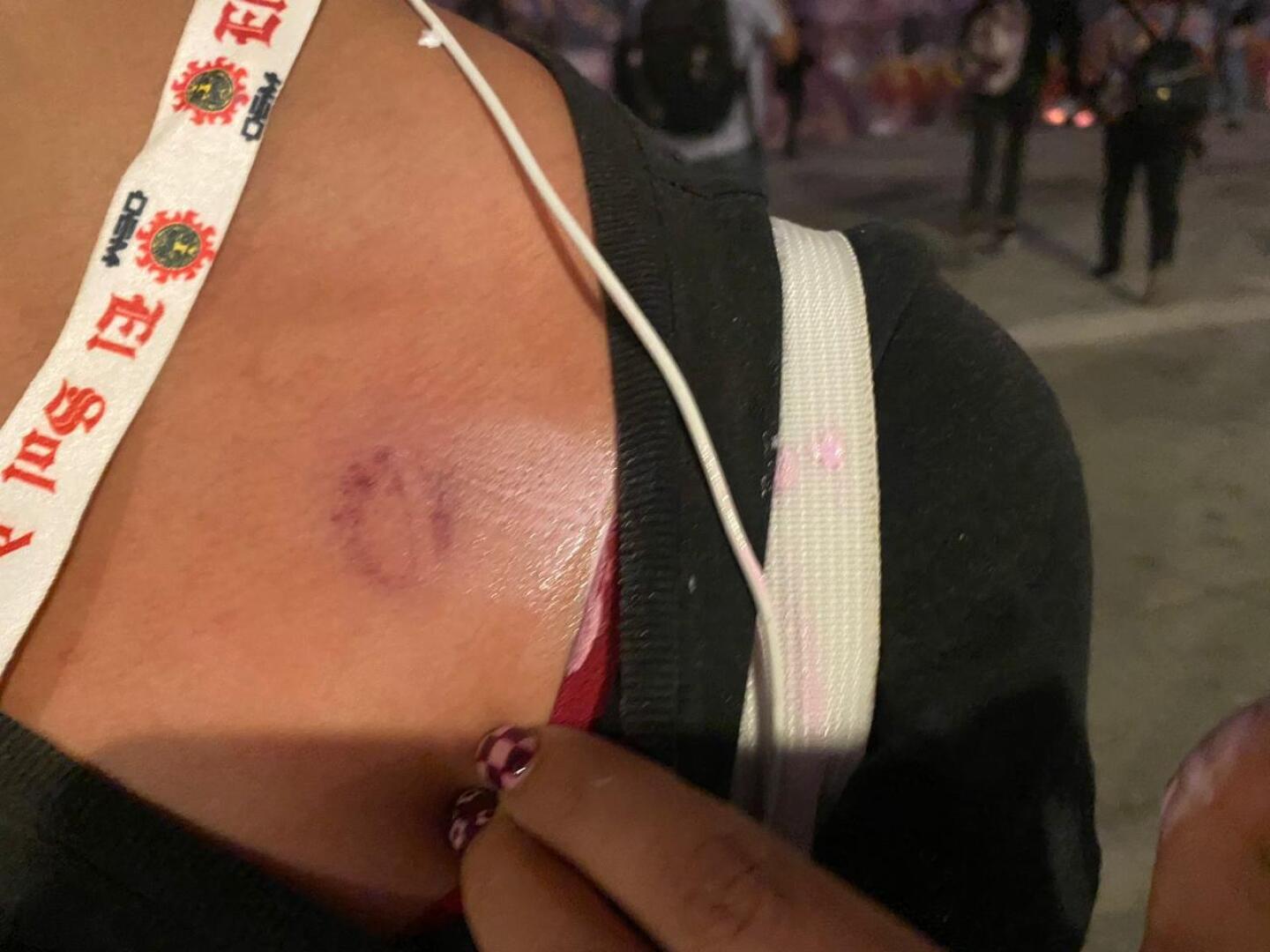 Feministas detenidas en Morelia