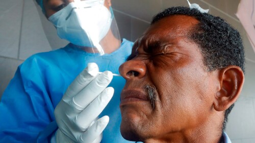 Prueba Coronavirus, Covid, test, Covid-19, Coronavirus, test coronavirus