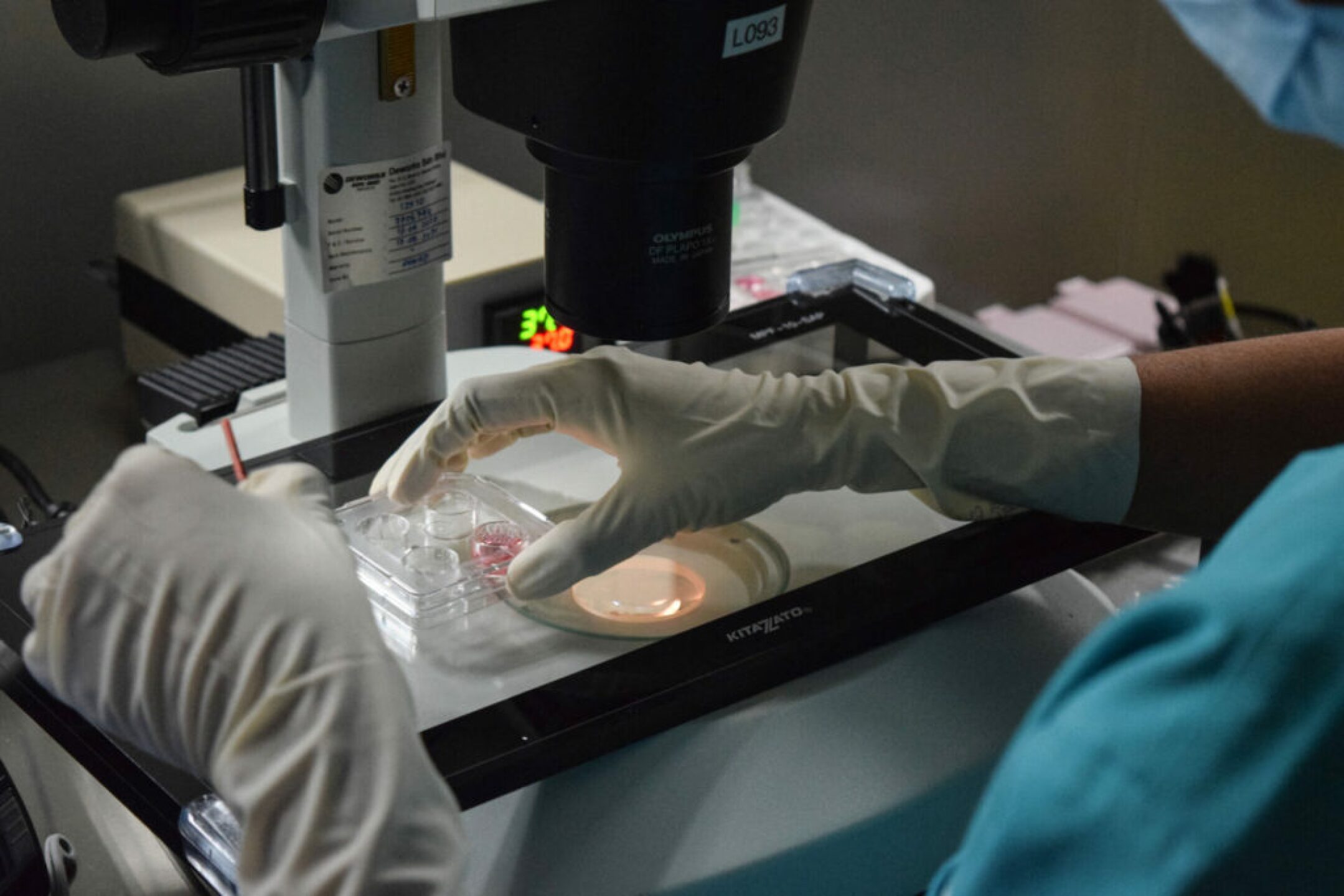 ovulos_congelacion_fertilidad_4-1024x683