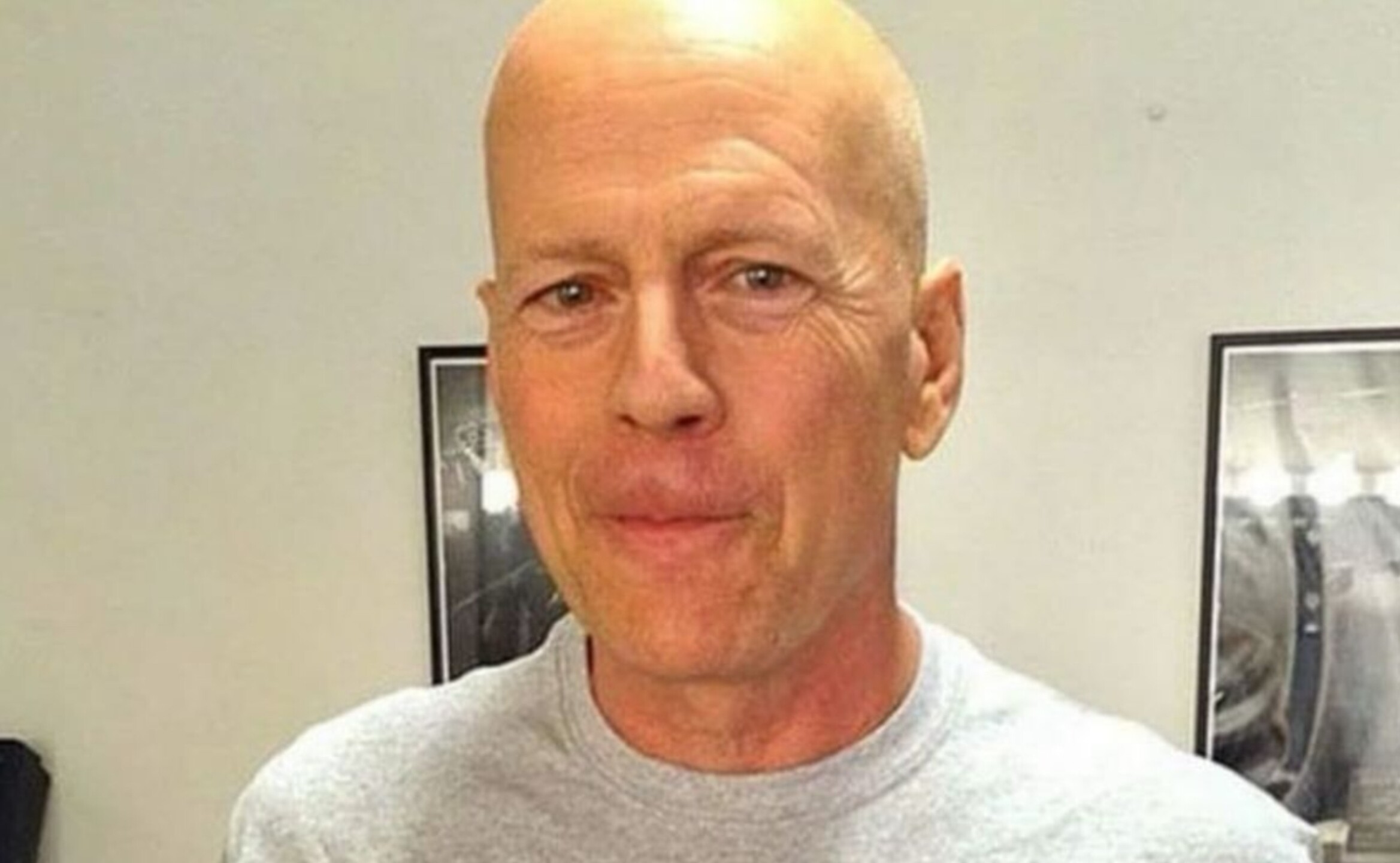 salud_bruce_willis_enfermedad_