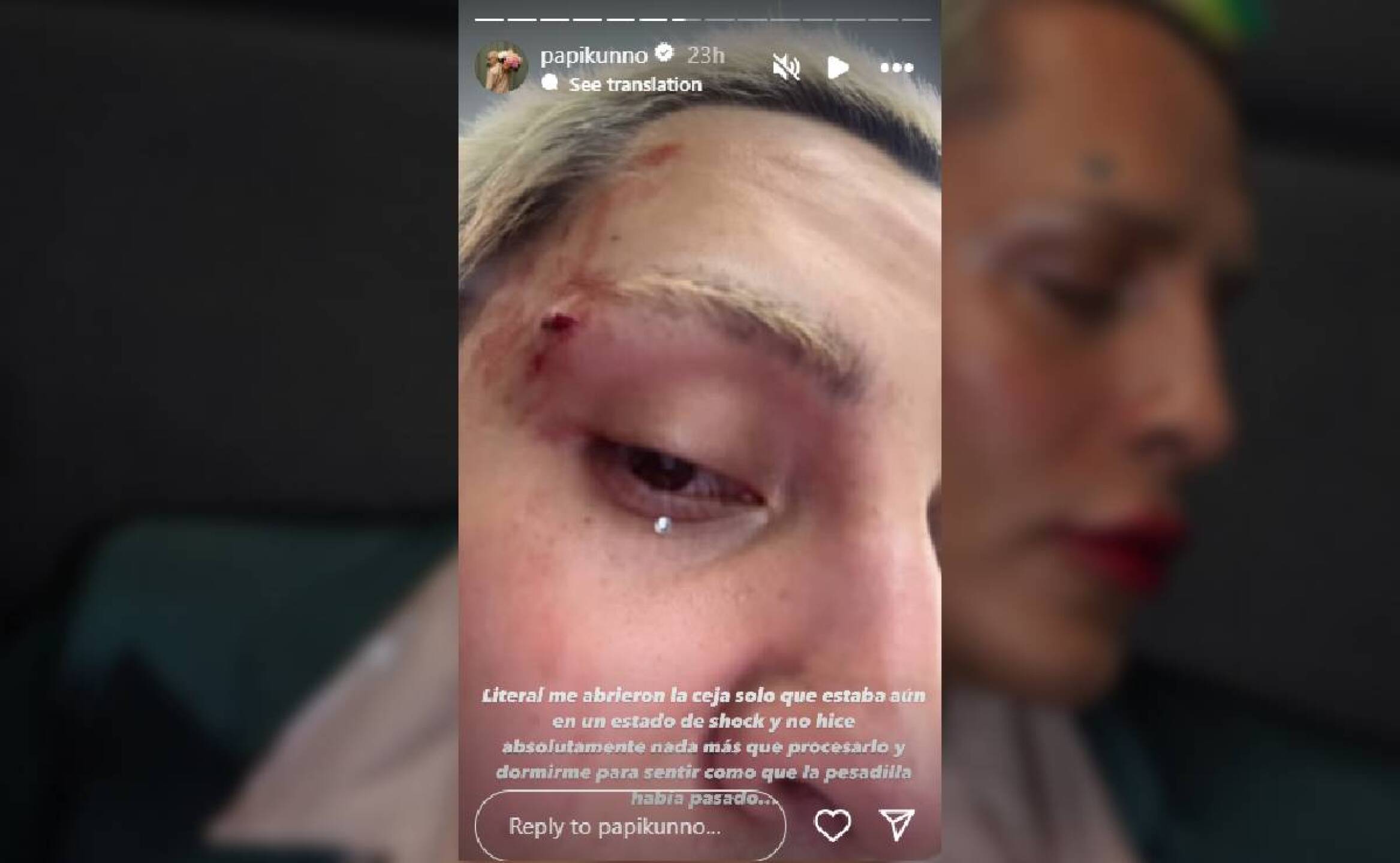 kunno-agresiones (2).jpg