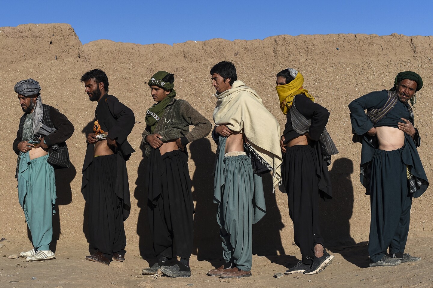AFGHANISTAN-ECONOMY-HEALTH-ORGANS