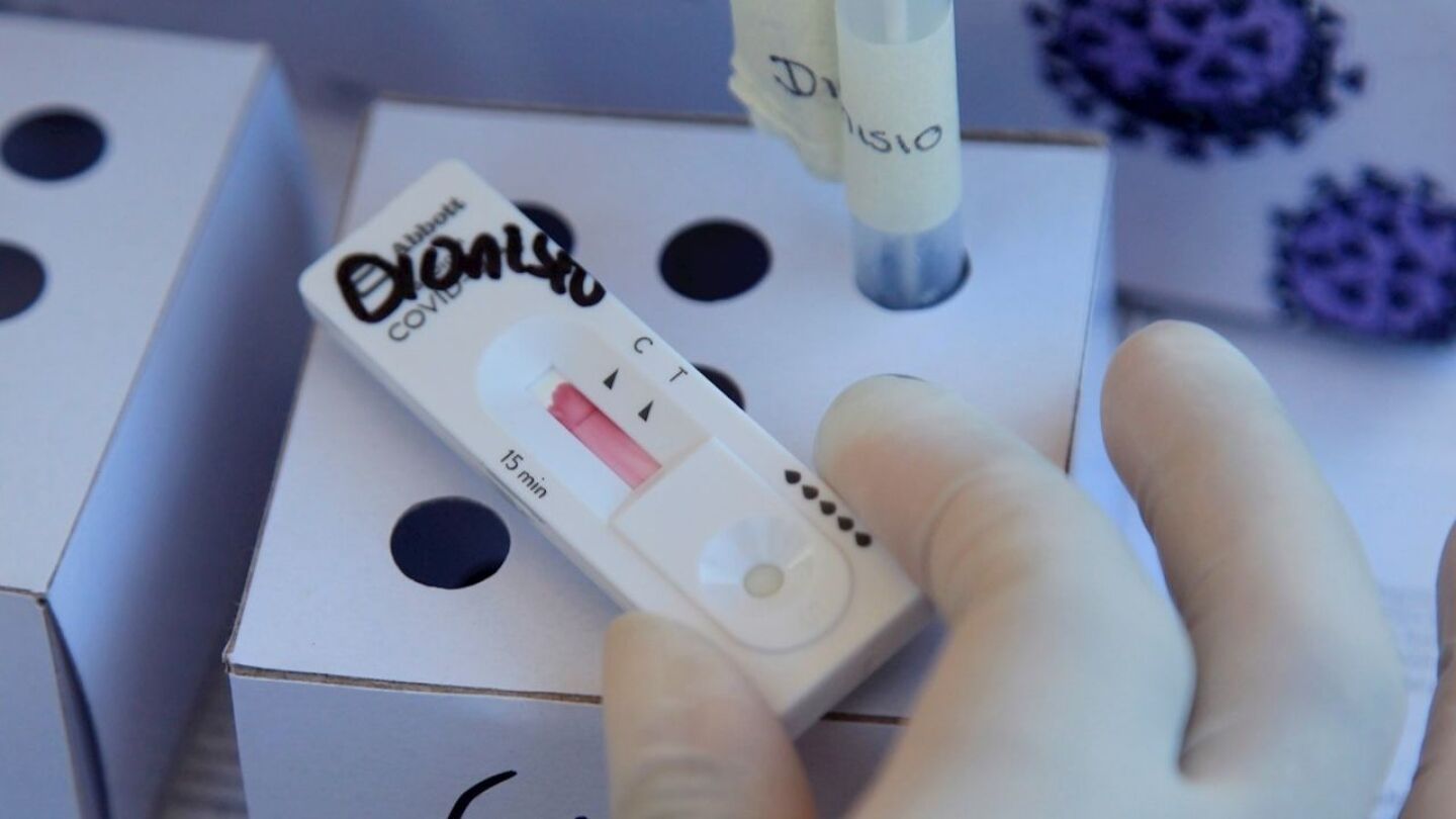 coronavirus-covid-19-pruebas-contagio