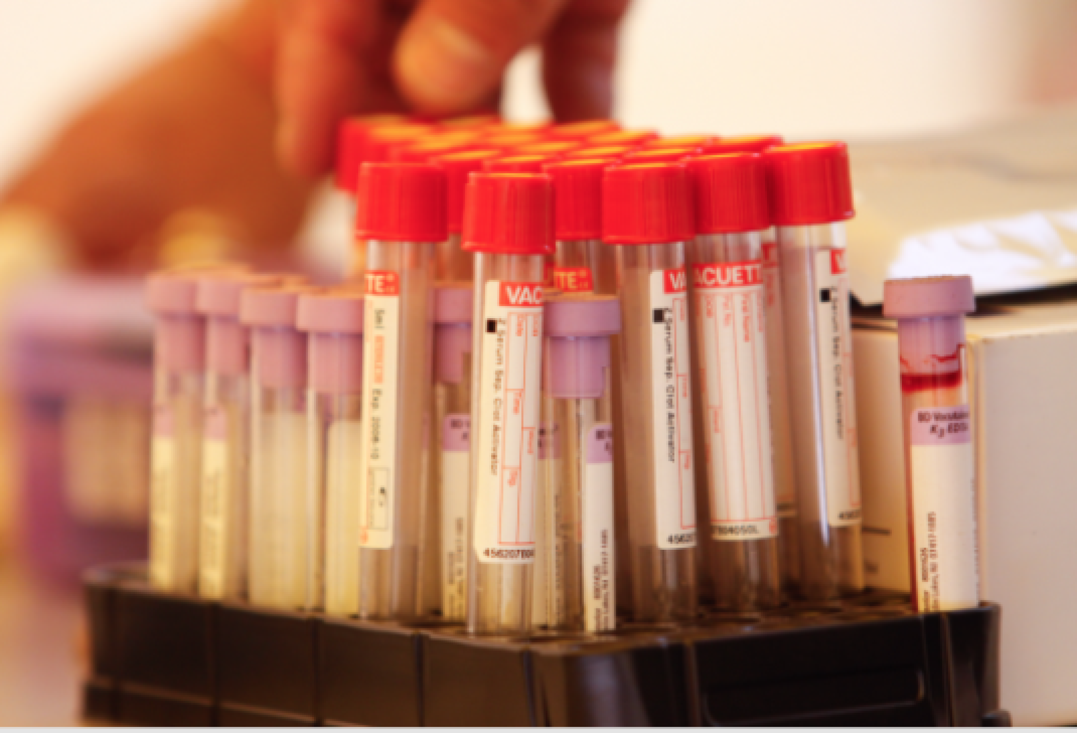 VIH-prueba_cuarto-535x364