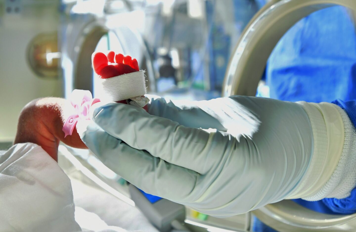 bacteria-klebsiella-oxytoca