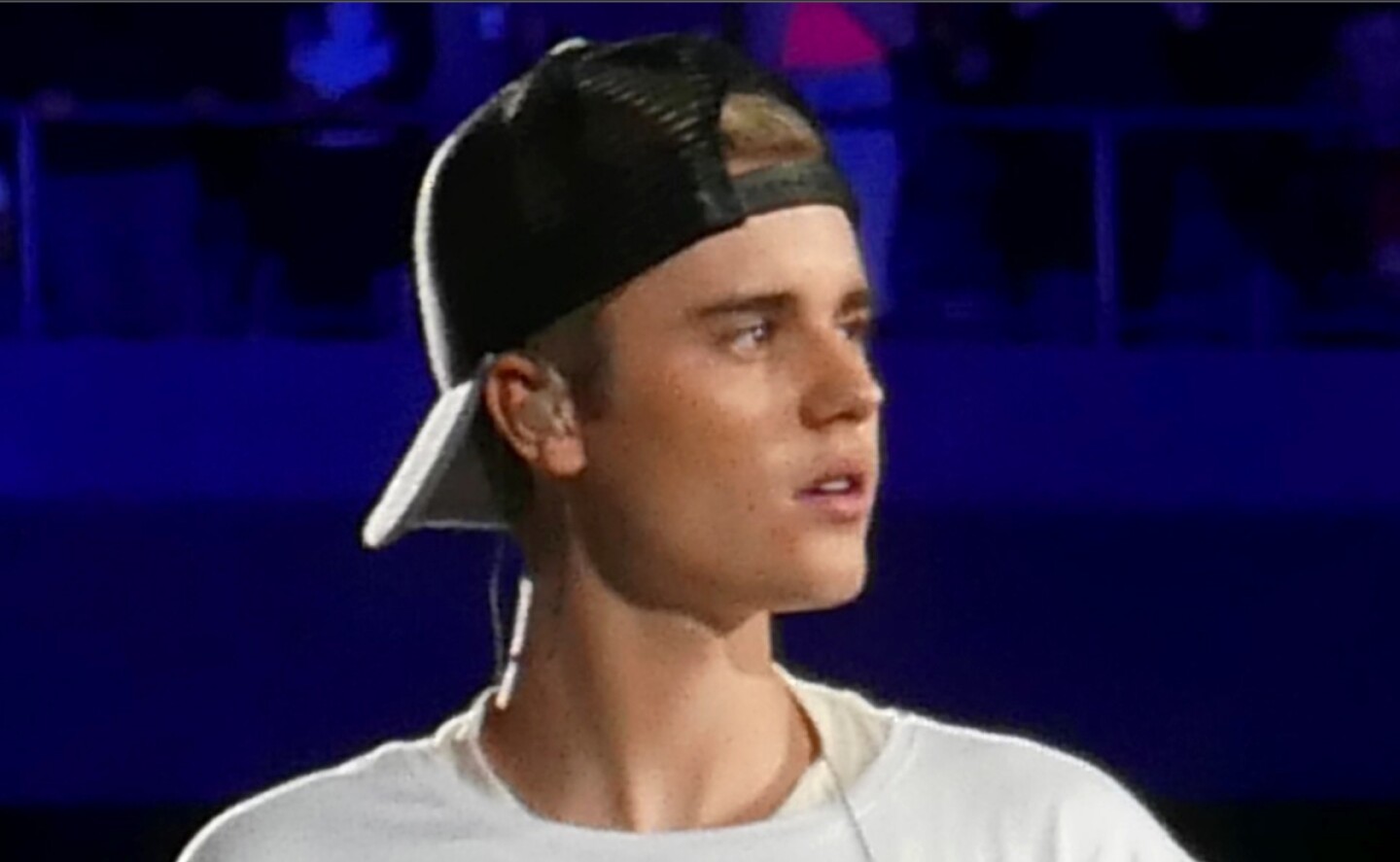 justin_bieber_enfermedades_raras_famosos