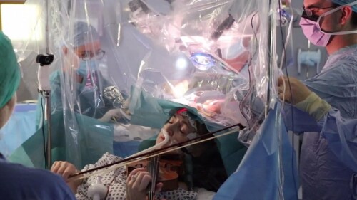 ejecentral_violinista_operacion_tumor_cerebral