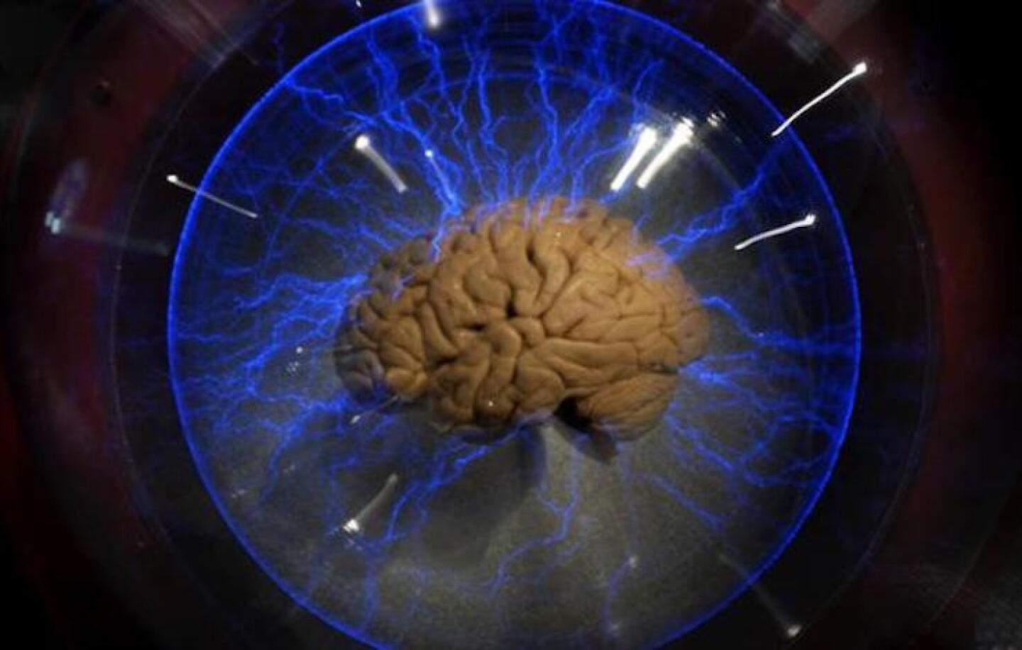Cerebro
