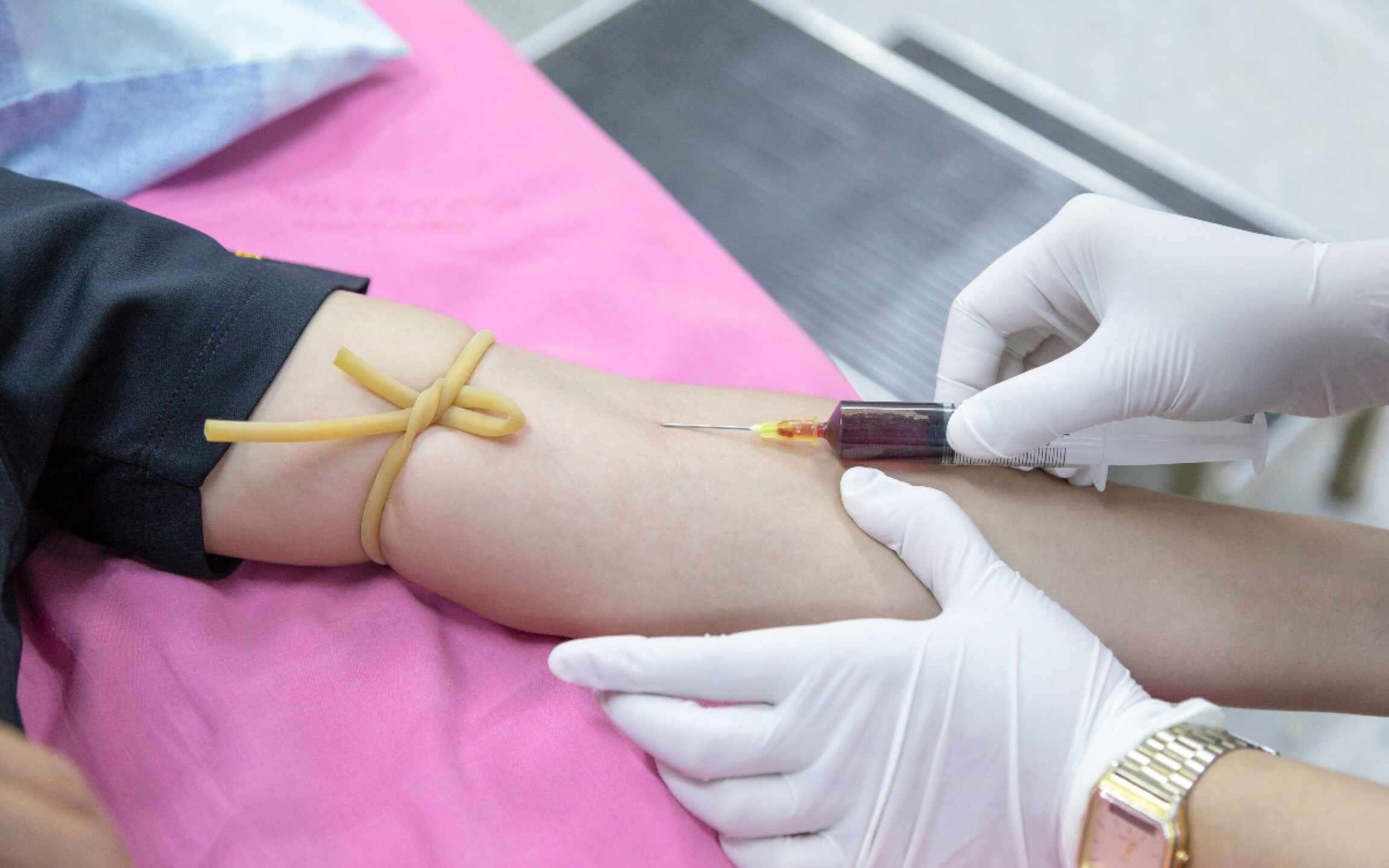 operacion-mujeres-para-no-tener-hijos