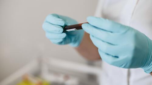 japon prueba de sangre alzheimer