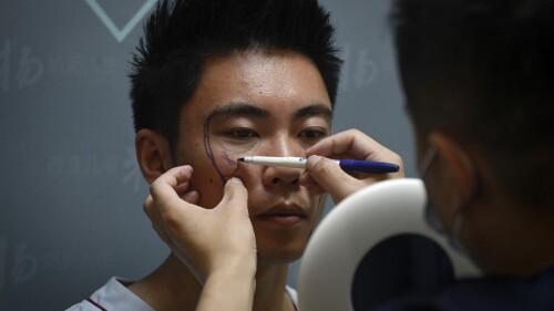 CHINA-SOCIAL-SURGERY-GENDER