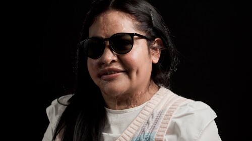 MEXICO-CRIME-VIOLENCE-GENDER-WOMEN-ACID