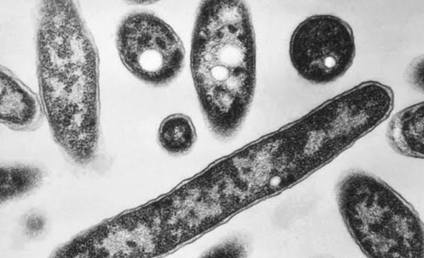 Legionella