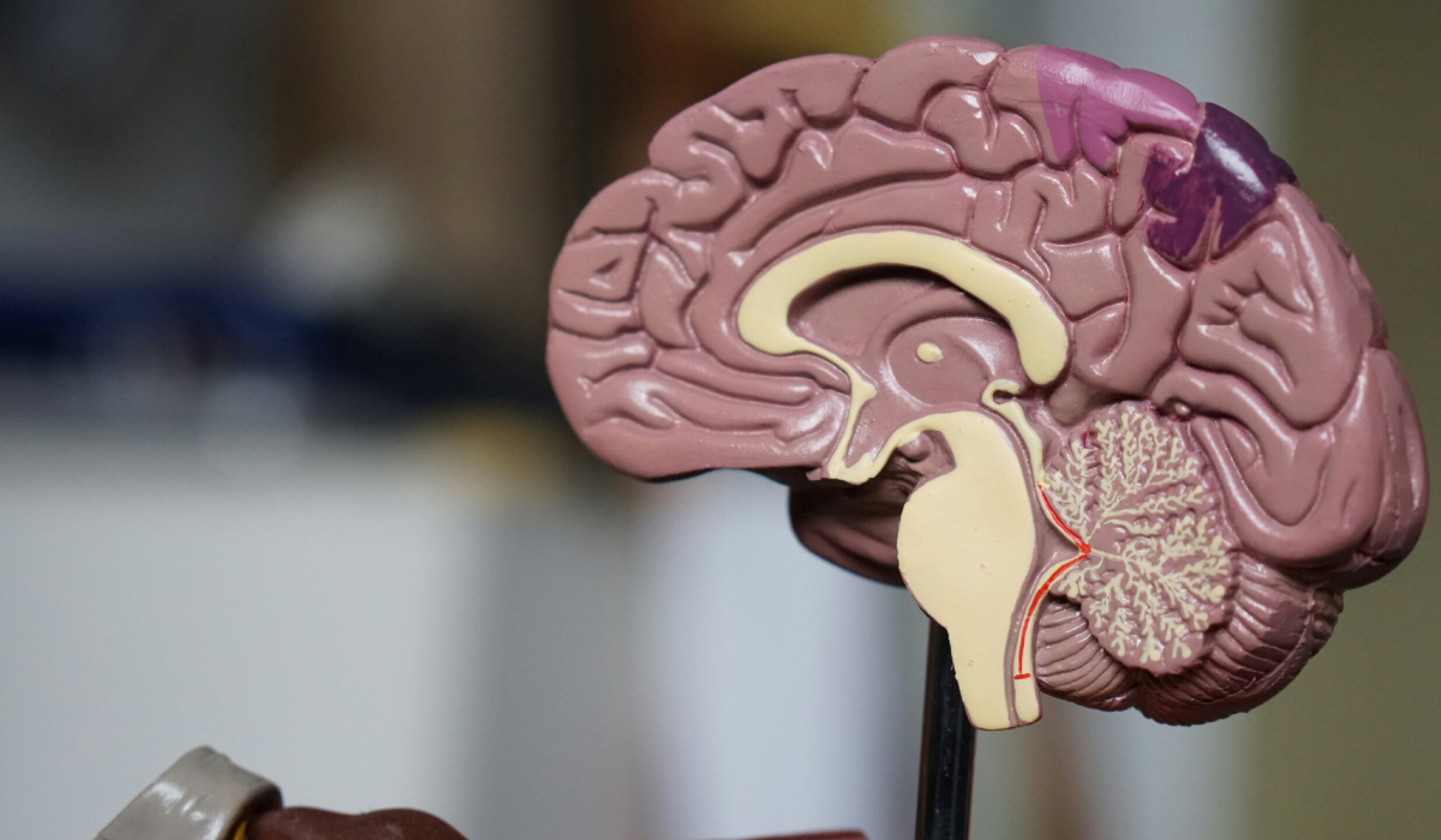 app mexiana parkinson(1).jpg