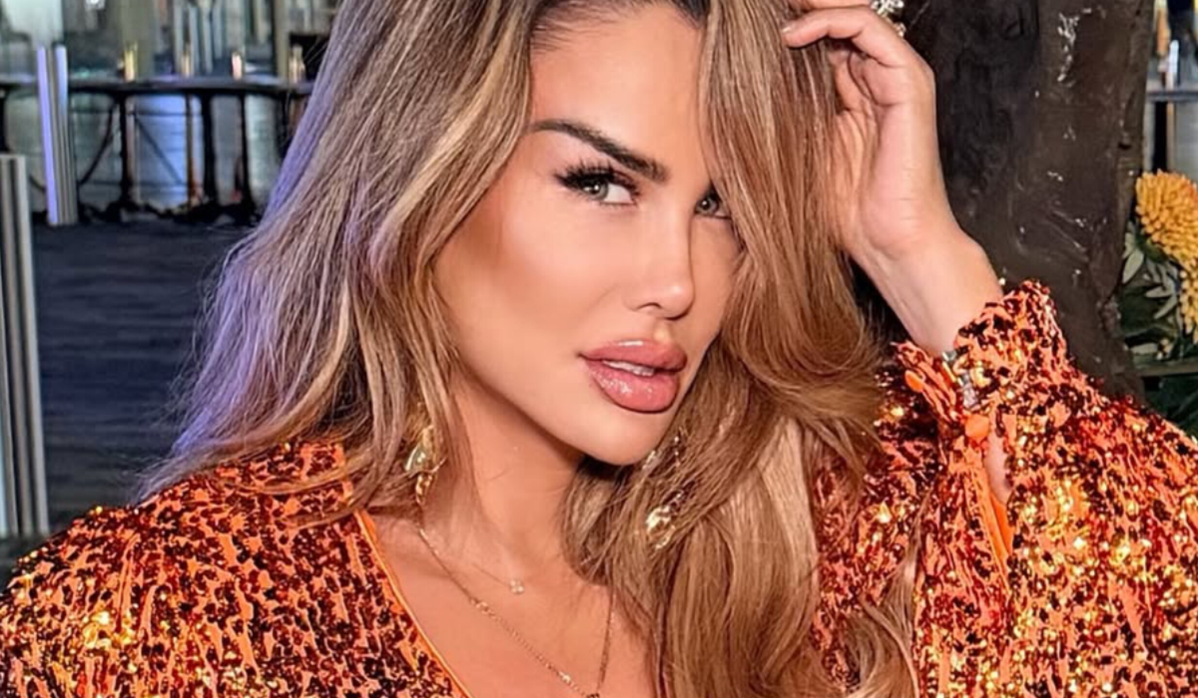 Ninel Conde cirugia ojos(3).jpg