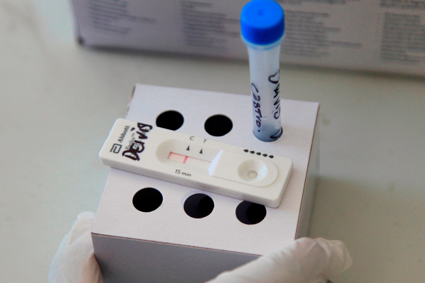 Prueba Coronavirus, Covid, test, Covid-19, Coronavirus, test coronavirus