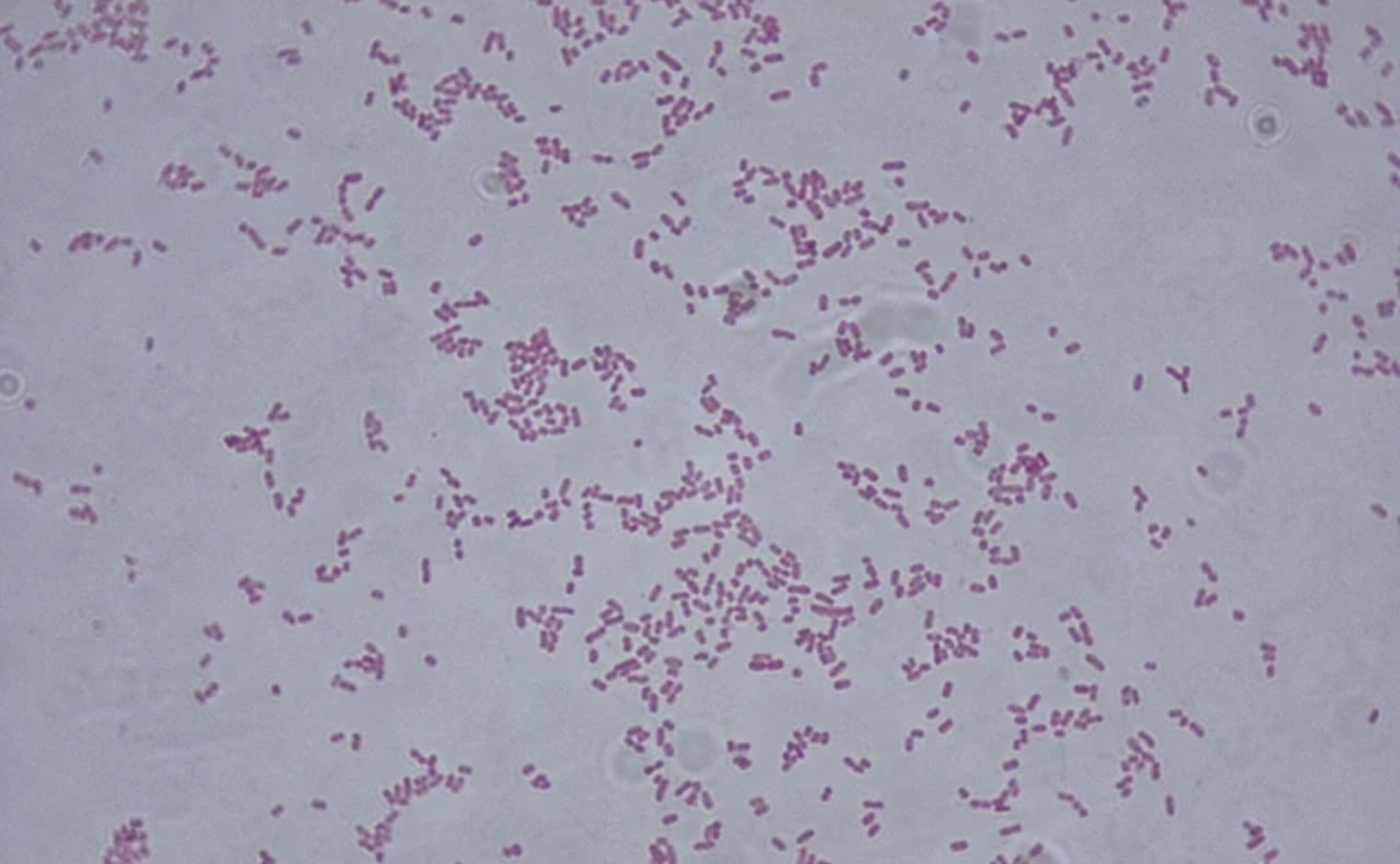 bacteria-Klebsiella_oxytoca