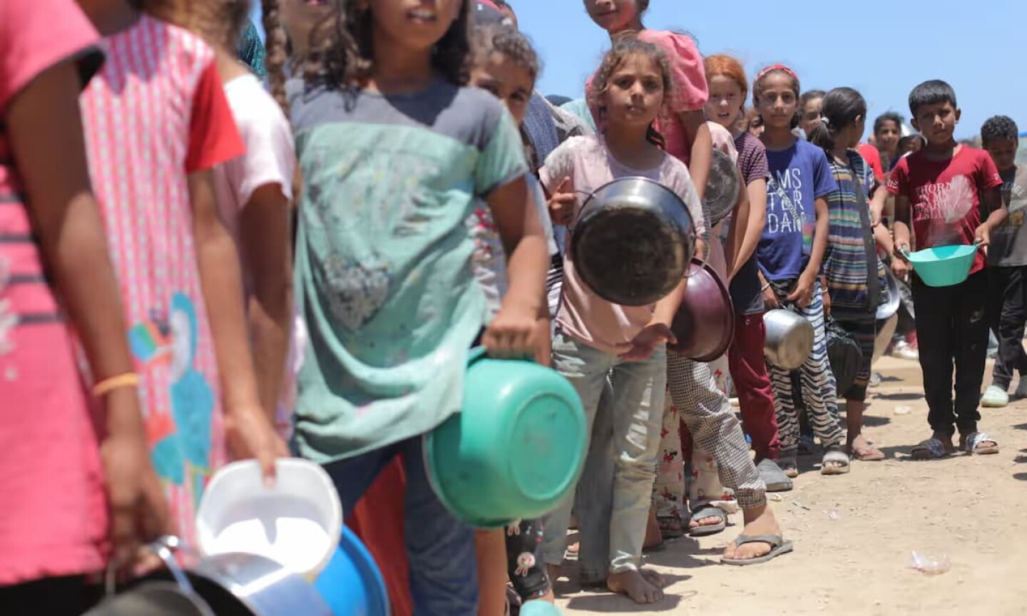 El hambre causa ya muchas muertes y daños irreversibles en Gaza