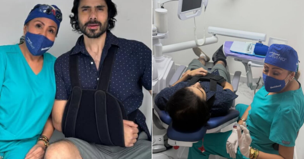 Filtran primeras FOTOS de José Ángel Bichir tras caer de un tercer piso: ¡perdió tres dientes!