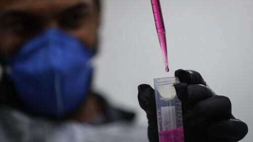 Sars-CoV-2-hepatitis-efe