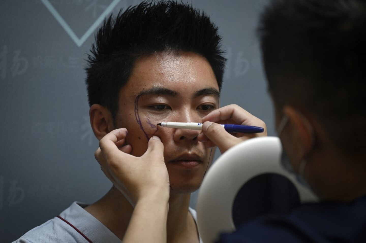 CHINA-SOCIAL-SURGERY-GENDER
