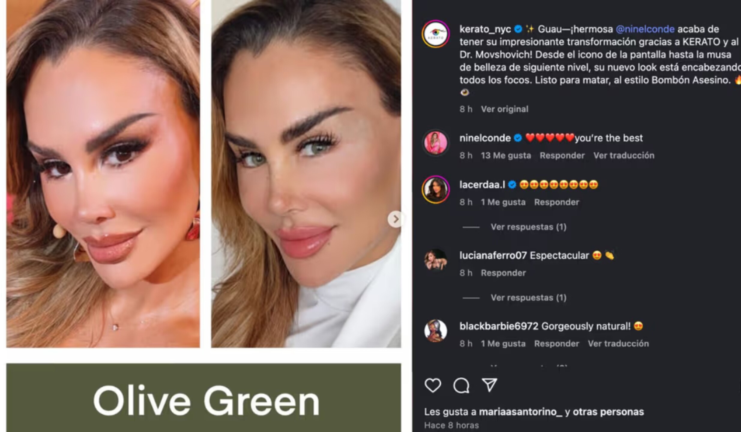 Ninel Conde cirugia ojos.jpg