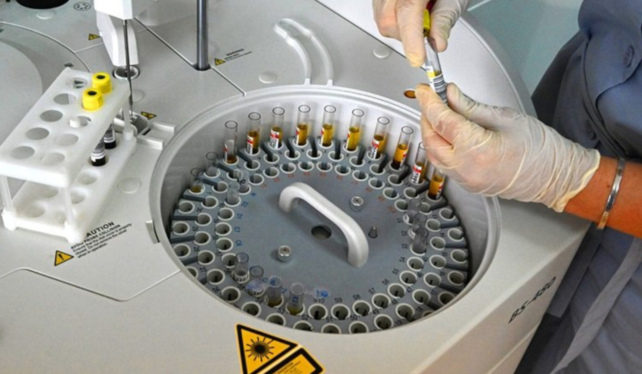 vacuna contra cancer rusia.jpg