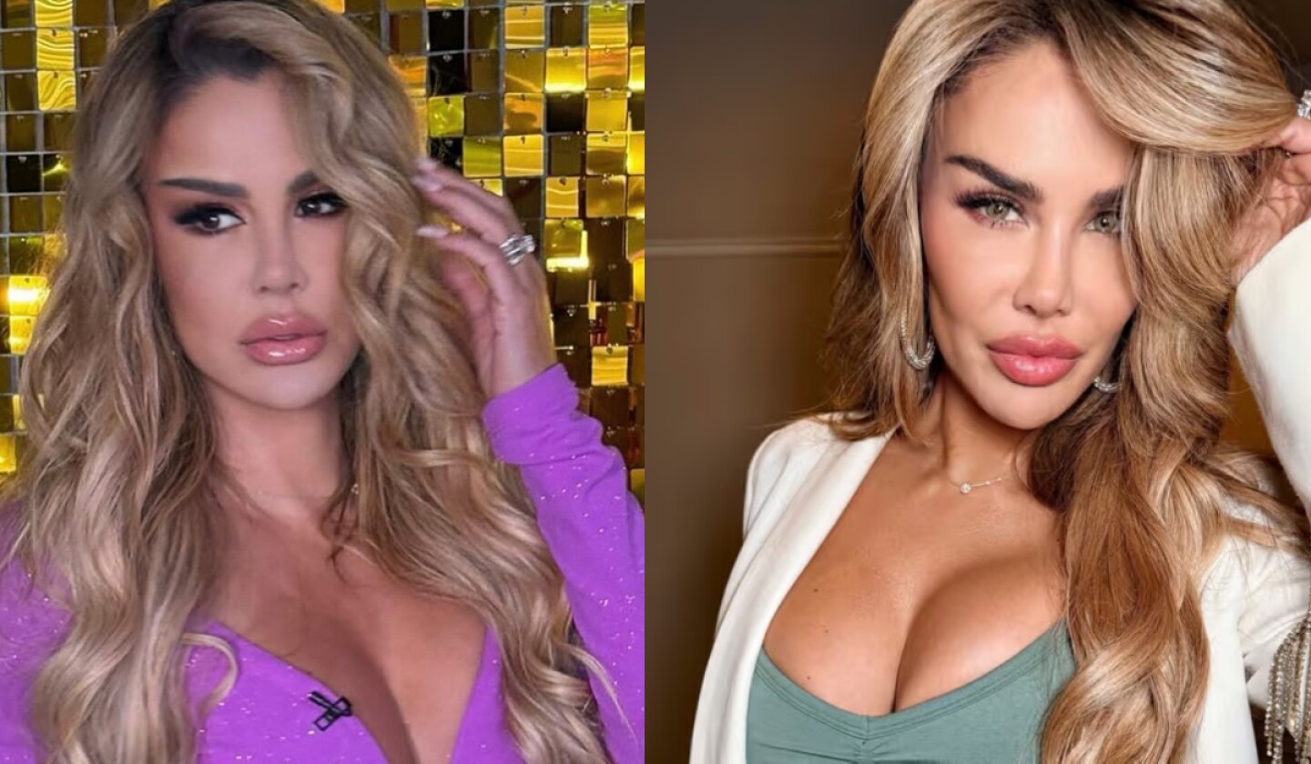 Ninel Conde cirugia ojos(2).jpg