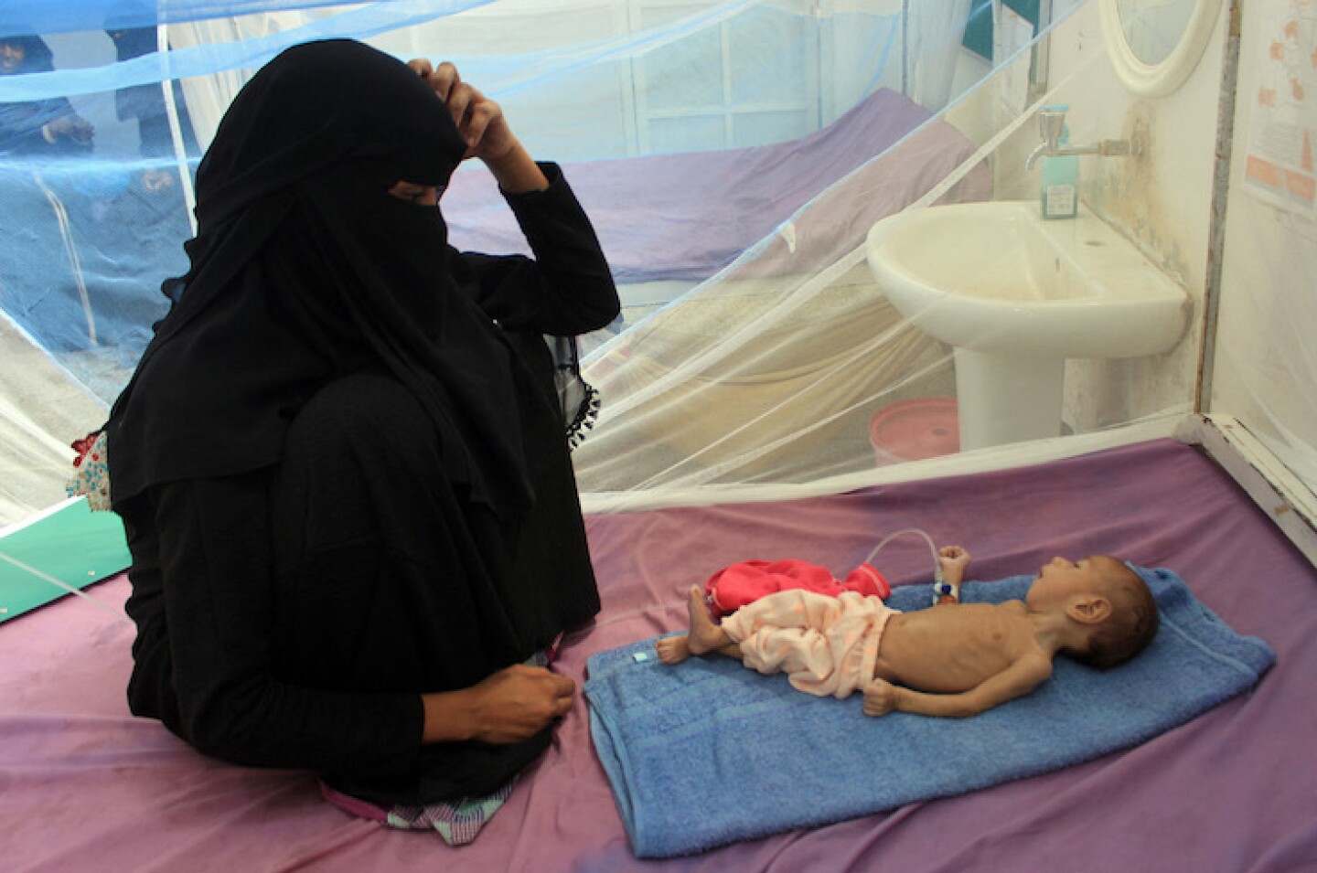 FILES-YEMEN-CONFLICT-CHILDREN-HEALTH