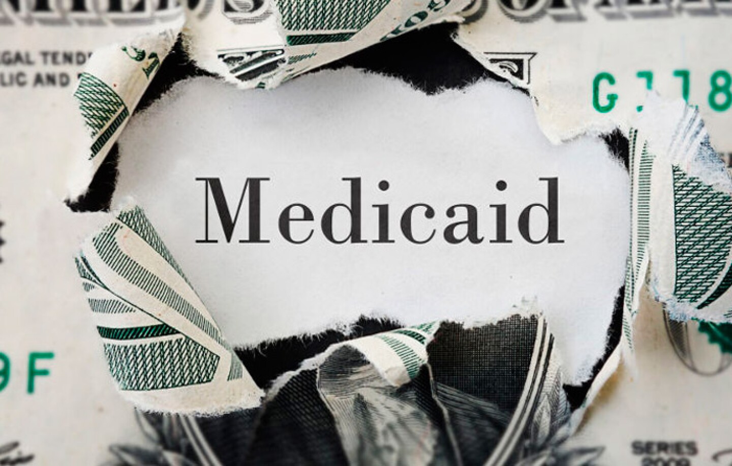 medicaid