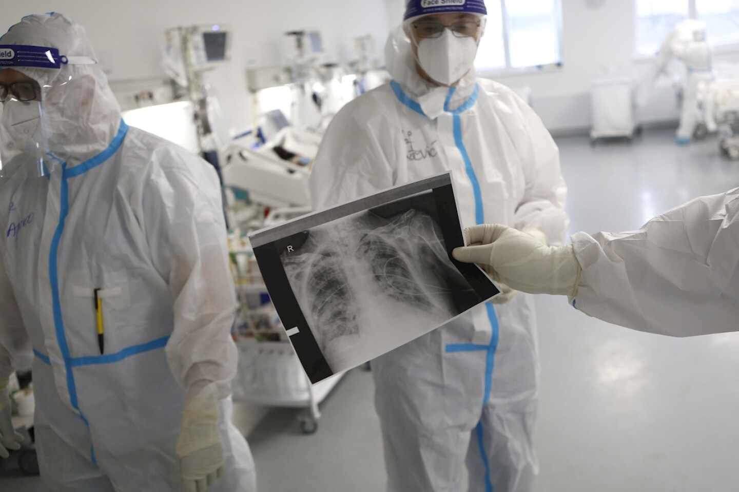 covid-estudio-pulmones