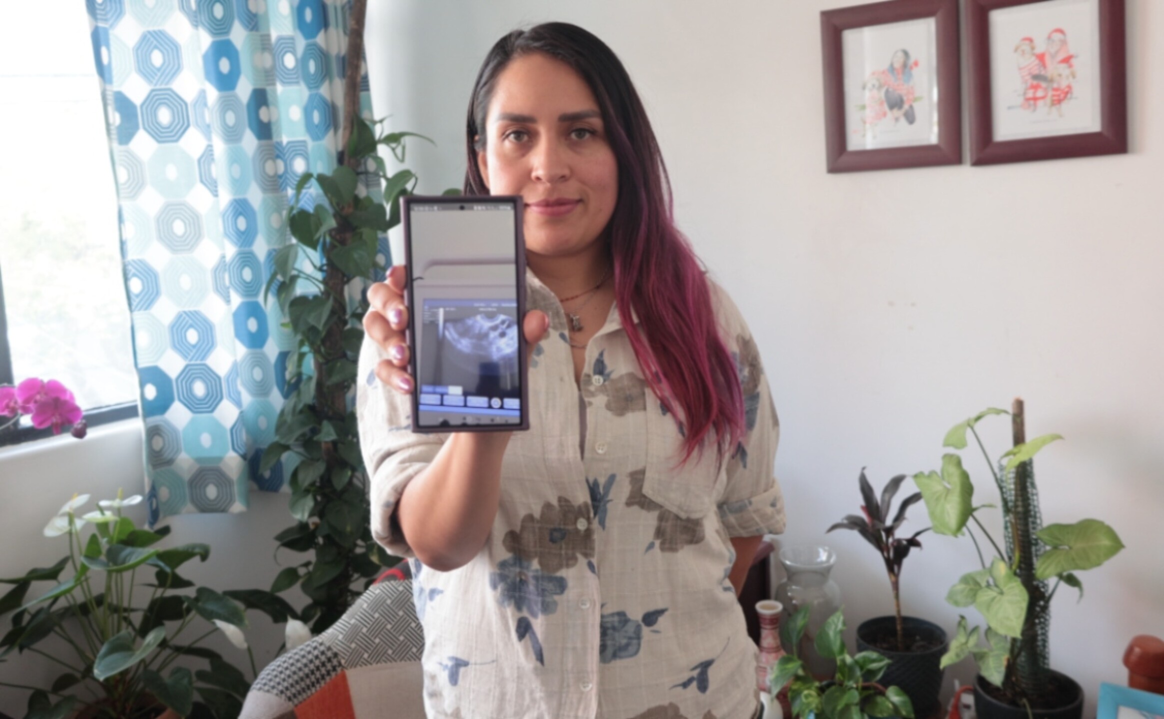 congelar-ovulos-para-que-sirve