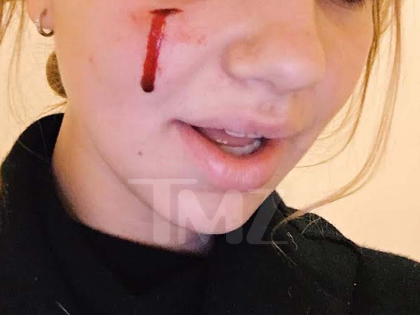 0112-obama-dog-bite-victim-6