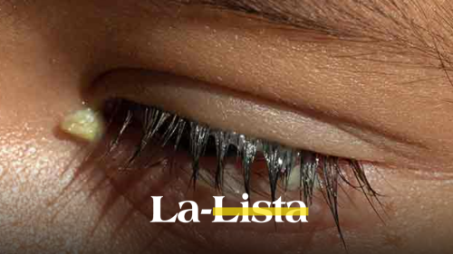 como-se-quitan-las-laganas-en-los-ojos-y-por-que-salen-al-despertar-estas-cinco-enfermedades-las-producen-sintomas.png