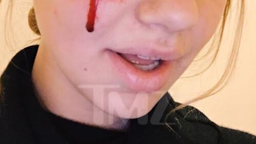 0112-obama-dog-bite-victim-6