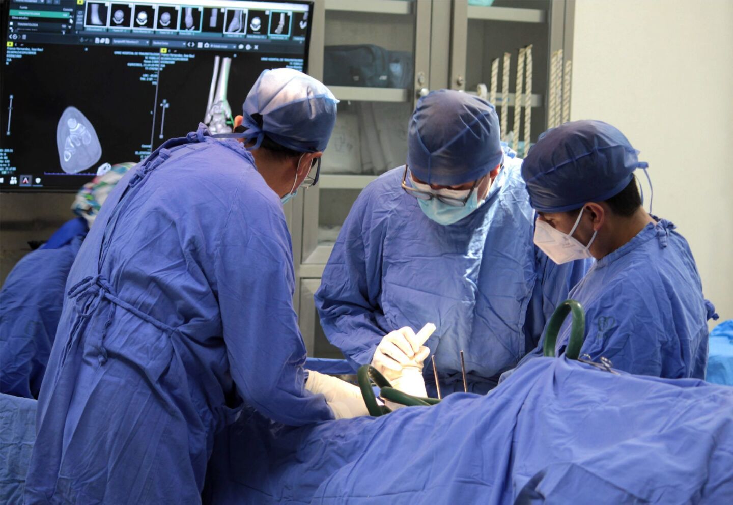 En onceava Jornada Nacional de Recuperación de Servicios, IMSS logró más de 3 mil Cirugías. En la imagen un equipo de médicos durante una operación.