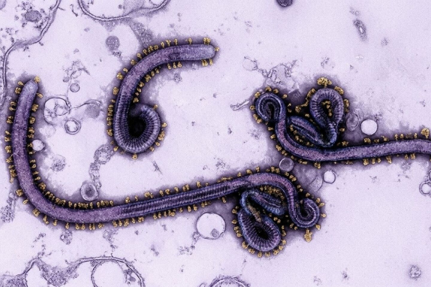 Cómo se contagia el Ébola? Principales señales de alerta que informó la OMS