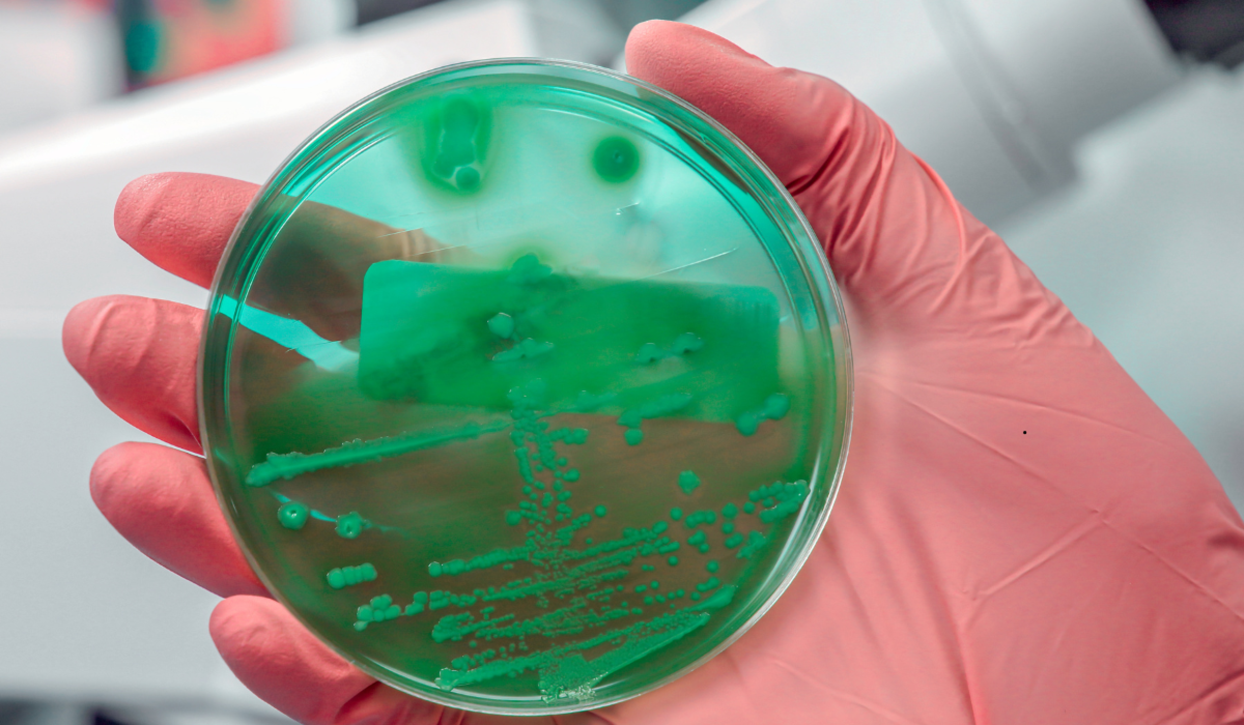 brote bacteriano de Klebsiella oxytoca