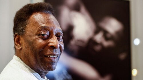Pelé es operado de un tumor en el colón y asegura que está "muy bien"